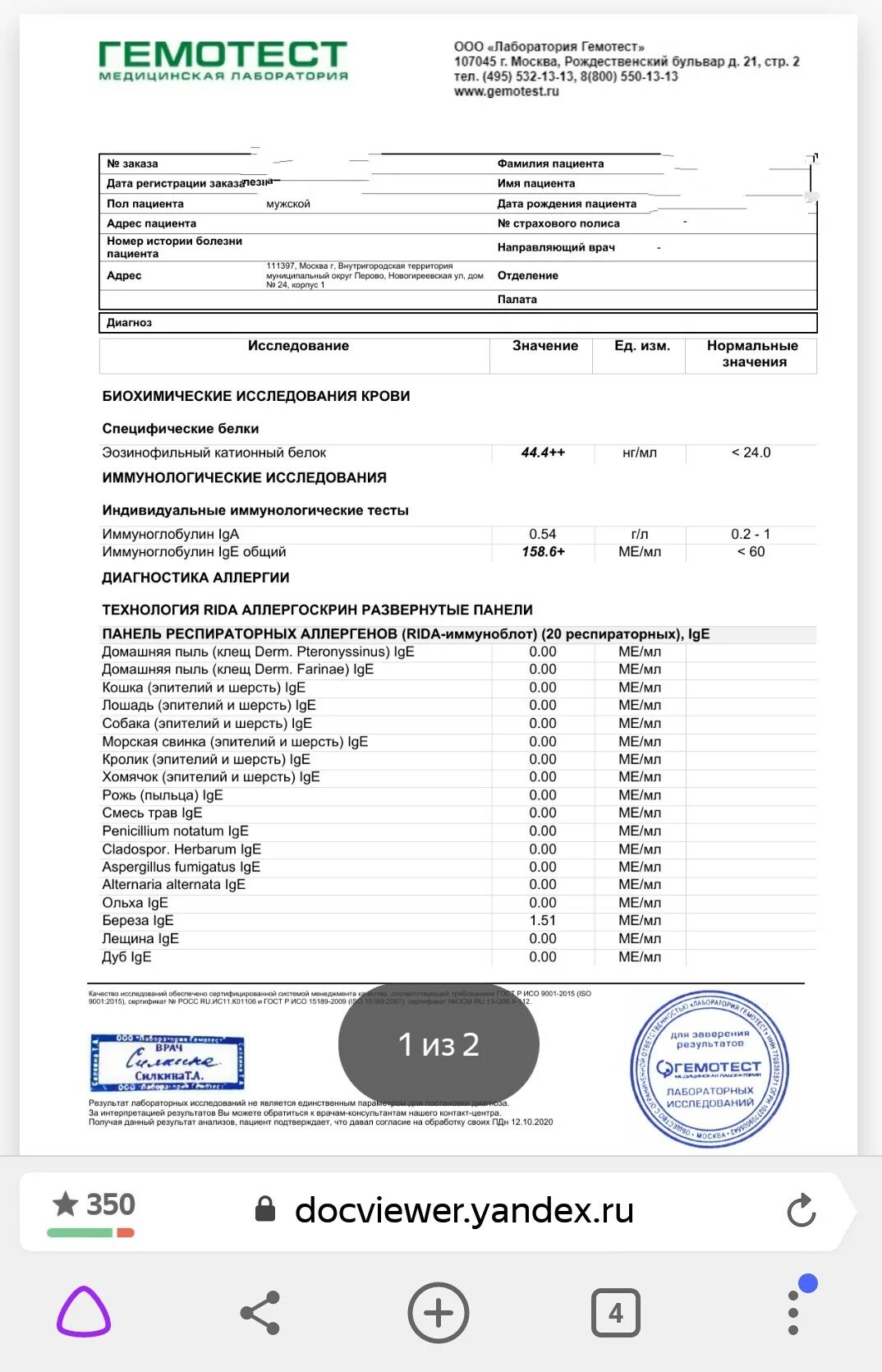 Анализ крови общий иммуноглобулин IGE. Анализ крови на общий иммуноглобулин е. Анализ крови на аллергию IGE расшифровка. Результаты анализ крови на иммуноглобулин е. Анализ иммуноглобулин е расшифровка