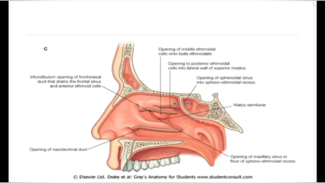 Костная основа полости рта. Дно полости носа анатомия. Нижняя стенка полости носа.