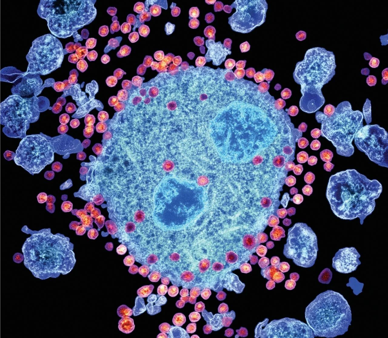 Human immunodeficiency virus. Клетка ВИЧ. СПИД иммунология.