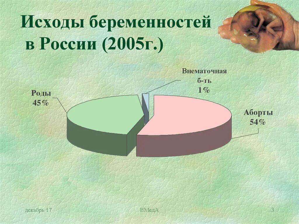 Статистика беременности в россии. Статистика беременности. Статистика замерших беременностей. Замершая беременность статистика по России. Статистика по замершей беременности.