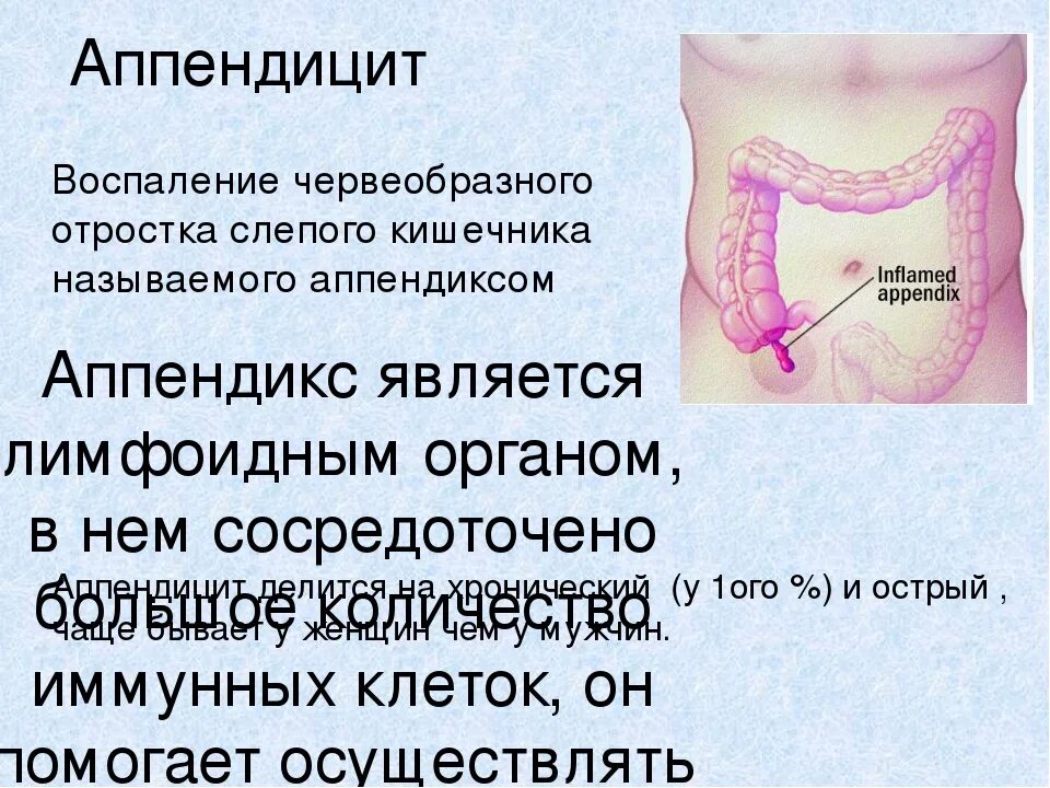 Аппендицит бывает у женщин. От чего воспаляется аппендицит.