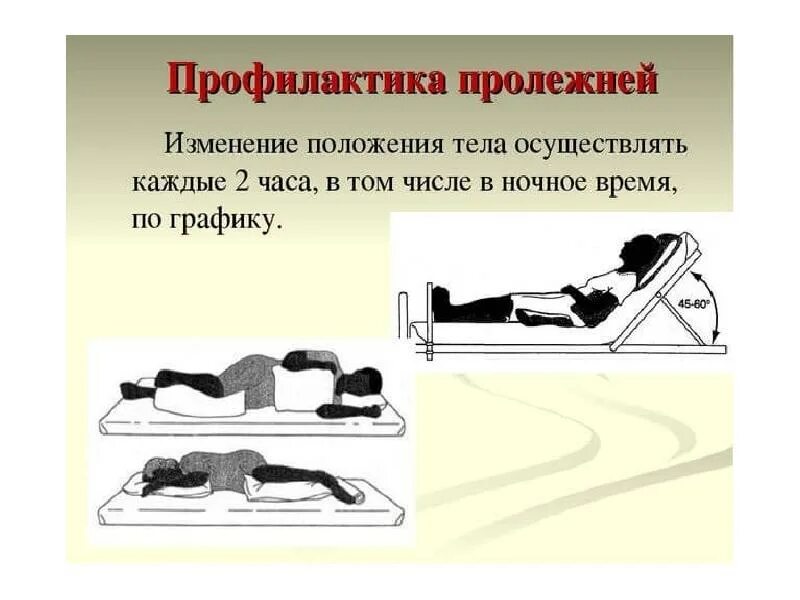 Чтобы не было пролежней у лежачего. Профилактика образования пролежней. положение тела при профилактике пролежней. профилактика пролежней у лежачих. изменение положения тела для профилактики пролежней.