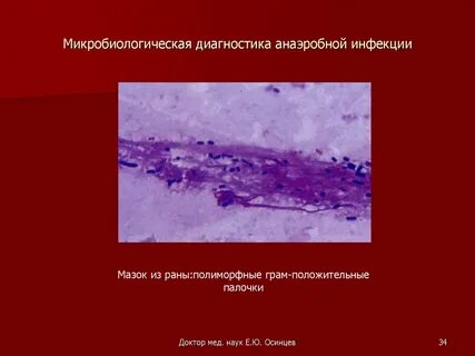 Тест анаэробные инфекции