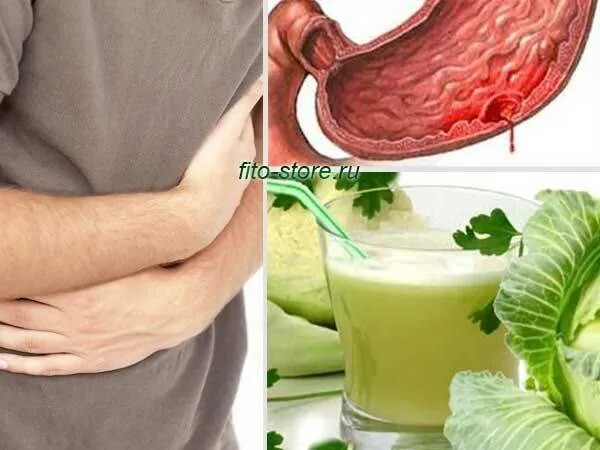 Картофельный сок для жкт. Картофельный сок при гастрите. Картофельный сок для похудения. Соки при язве желудка. Лечение гастрита соками.