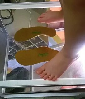 Стельки при вальгусной деформации