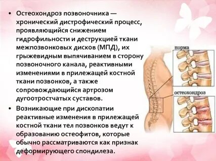 Снижение позвонков