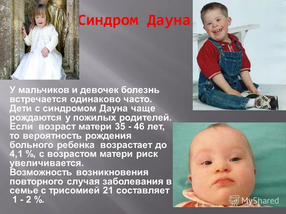 Синдром дауна это чаще всего. Синдром дауна. новорождённые дети с синдромом дауна.
