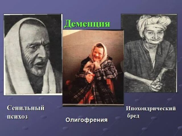Период старости у животных. Сенильный психоз. Сенильный остеопороз. Диагноз остеопороз сенильный. Старческий остеопороз.