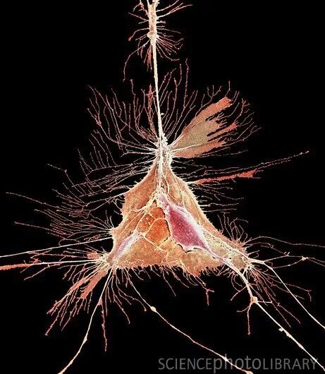 Как выглядит нейрон под микроскопом Astrocytic glial cell with cortical neuron, SEM Stock Image C036/9804 Scie