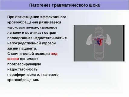 Патогенез травматического шока