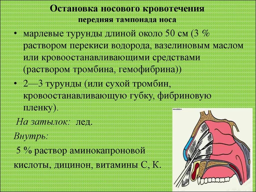 Остановка носового кровотечения. Остановка родового кровотечения. Остановка кровотечения из носа. Причины носового кровотечения.