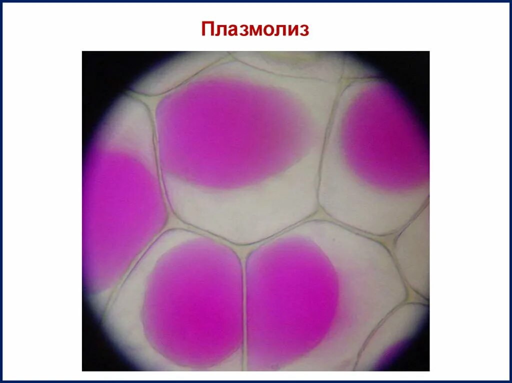 Лук плазмолиз. Лук плазмолиз. Лук плазмолиз. Лук плазмолиз. Лук плазмолиз.