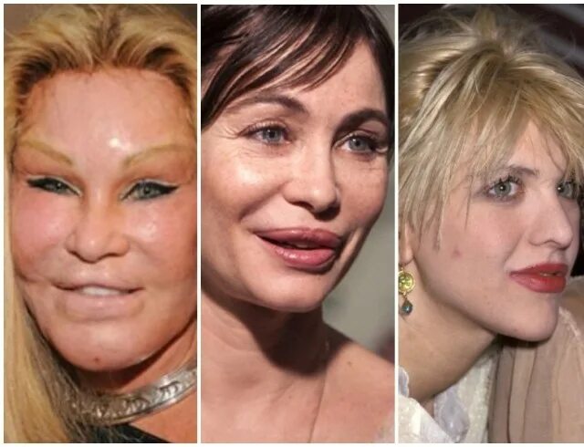 Сделала неудачную пластику
