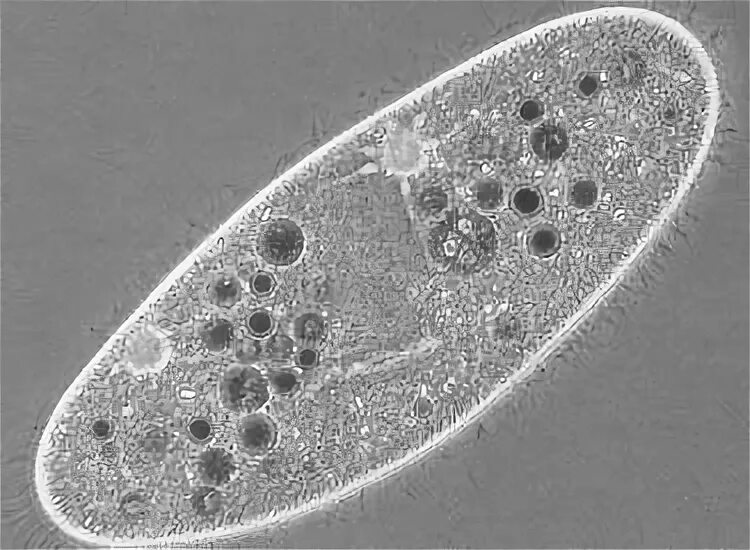 Balantidium coli под микроскопом. Инфузория морфология. Циста балантидия. Balantidium coli строение. Циста балантидия.