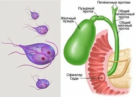 Паразиты в желчном