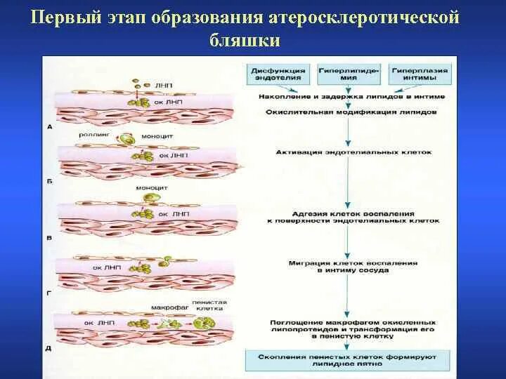 Стадии атеросклеротической бляшки. Схема формирования атеросклеротической бляшки. этапы образования атеросклеротической бляшки. морфогенез атеросклероза (стадии развития). этапы формирования атеросклеротической бляшки.
