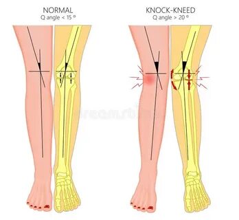 Что значит leg