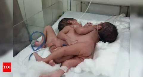 Conjoined twins masturbate.