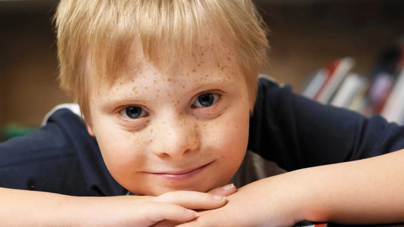 дети с нарушением зпр. дети с нарушением интеллекта. дети с интеллектуальной недостаточностью. ребенок даун. школа для отсталых детей.