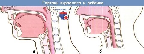 Гортань у детей