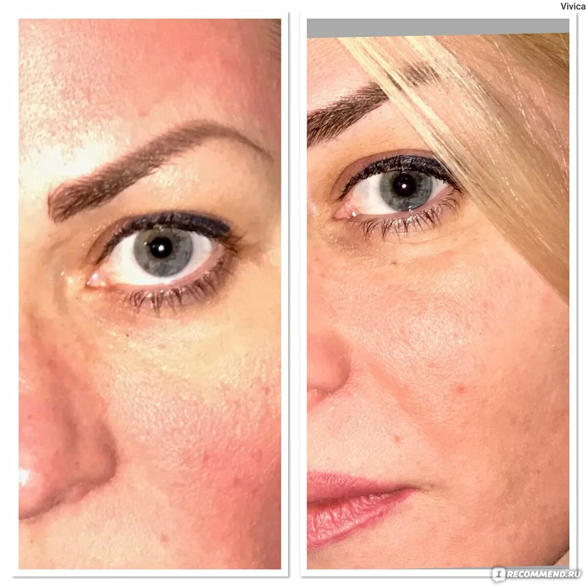 Пилинг роз. Пилинг роз. Пилинг роз. Коралловый пилинг для лица rose de mer christina. Пилинг роз.