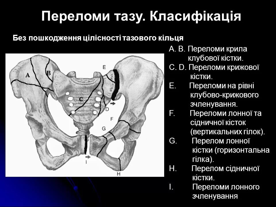 Кт подвздошной кости