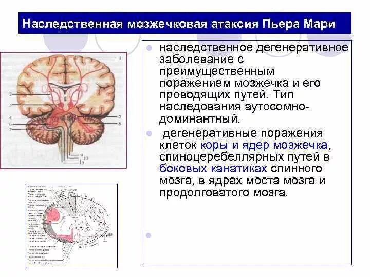 Мозжечковая атаксия очаг поражения. Симптомы поражения червя мозжечка неврология. Симптомы, характерные для поражения мозжечк. Спиноцеребеллярная атаксия 1 типа. Мозжечковая опухоль