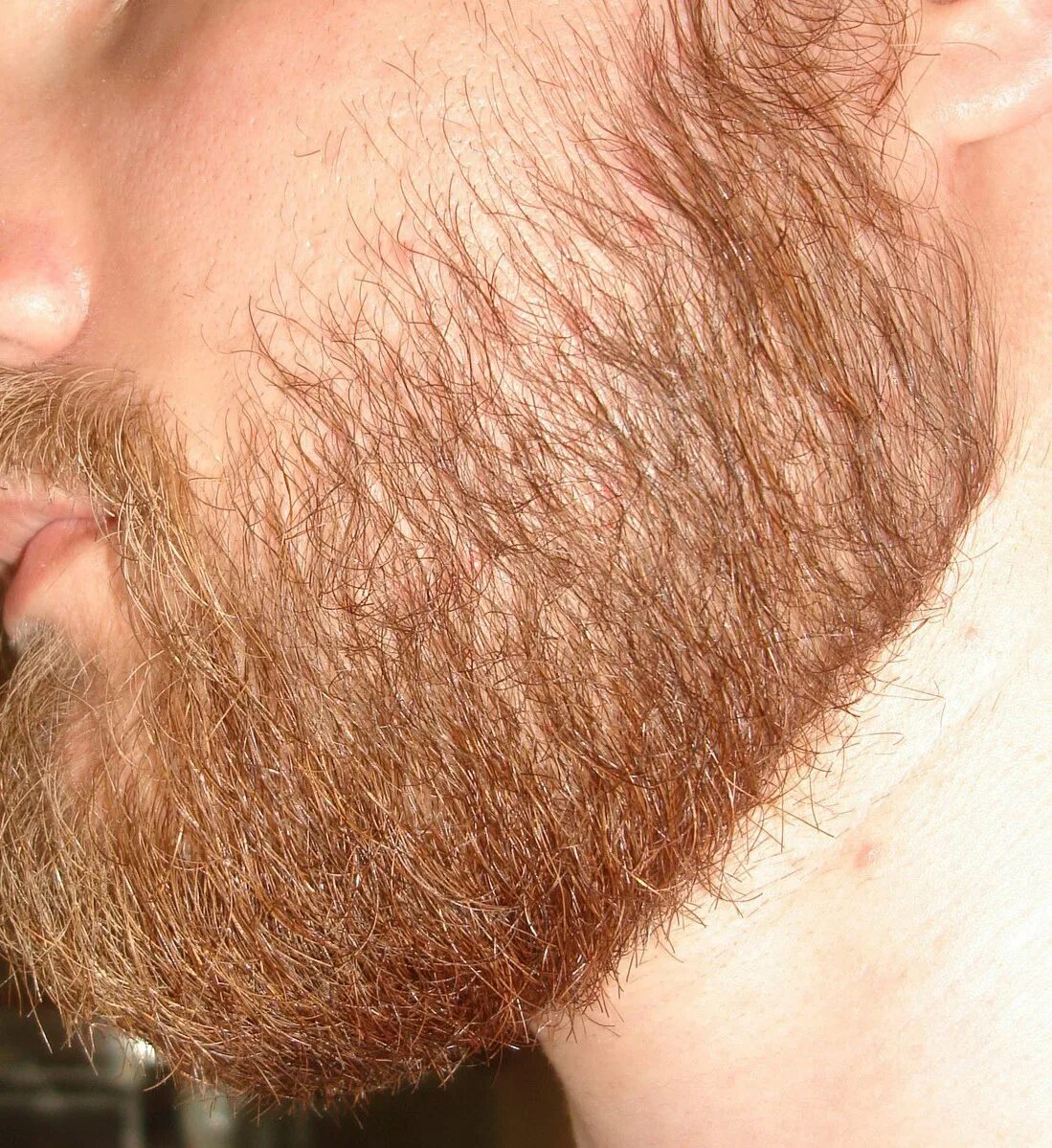 Перхоть на бороде. Миноксидил для бороды. Миноксидил для бороды для мужчин. Краска для бороды для мужчин.
