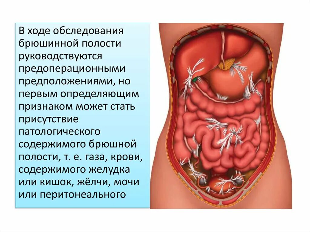 Ревизия внутренних органов. Ревизия брюшной полости. ревизия органов брюшной полости. эндометриоз брюшной полости. эндометриома брюшной полости.