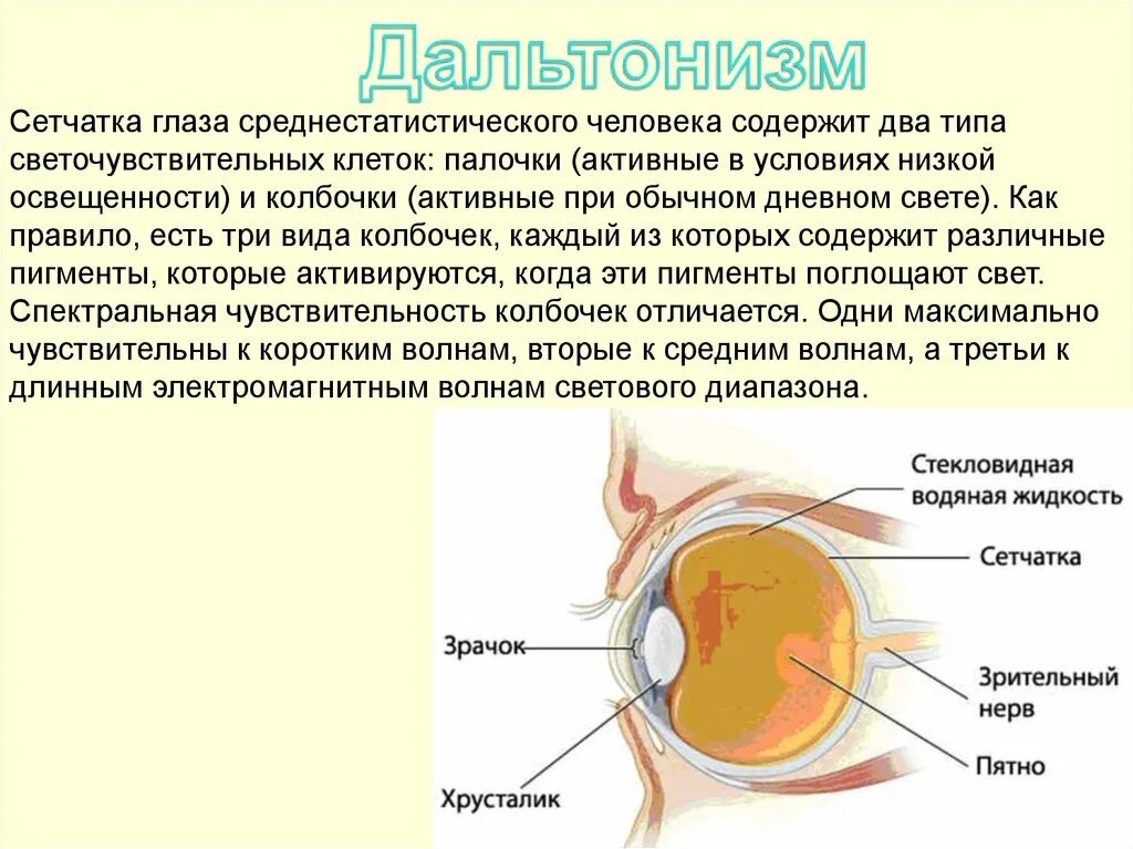 Дальтонизм строение глаза. Строение глаза при дальтонизме. Дальтонизм сетчатка. Светочувствительные клетки глаза. Жидкость в сетчатке