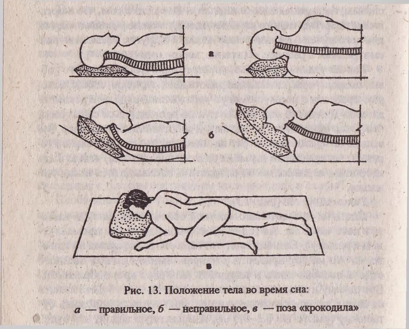 положение тела во время. положение тела во время. правильная поза для сна при шейном остеохондрозе. правильное положение для сна. правильная поза для сна.