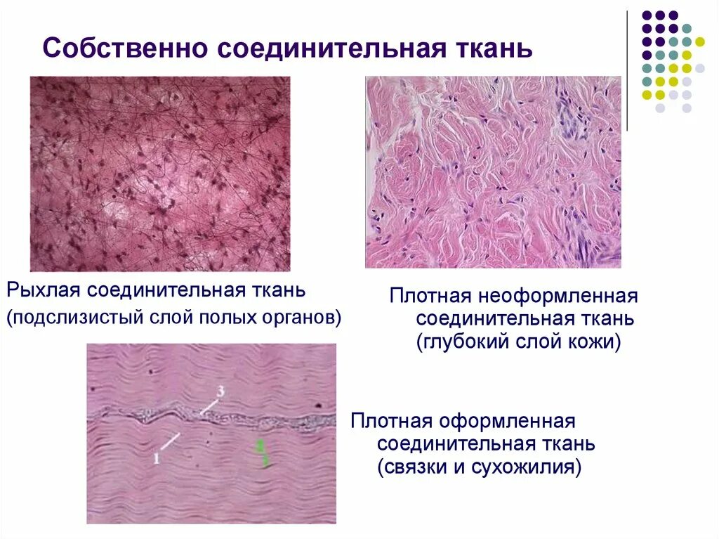 Рисунок волокнистой соединительной ткани