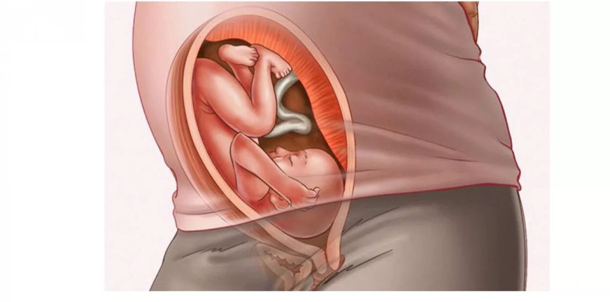Расположение плода на 29 неделе беременности. Малыш на 29 неделе беременности в животе. Расположение ребенка на 28 неделе беременности. Расположение ребенка на 29 неделе беременности. 27 недель болит живот