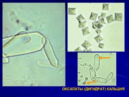 Кристаллы оксалаты