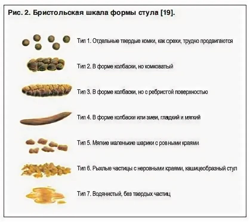 Нормальный кал. Плавающий кал причины и лечение. Бристольская шкала кала запор. Кал чёрного цвета у взрослого. Бристольская шкала формы кала у детей.