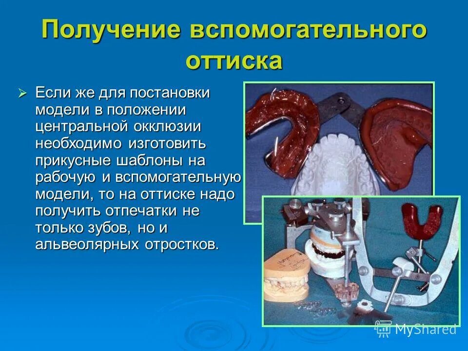 Получение рабочего оттиска. Получение рабочего оттиска. Получение рабочего оттиска. Получение двойного оттиска. Получение рабочего оттиска.