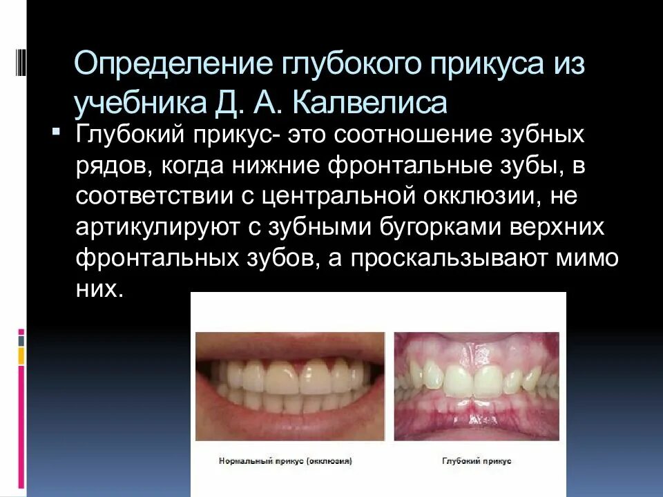 Определить глубокий
