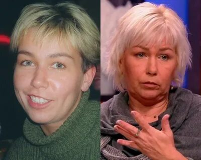Стриж после пластики