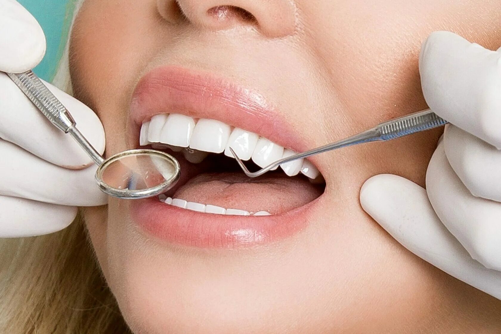Восстановление скола зуба. Стоматология восстановление зубов.