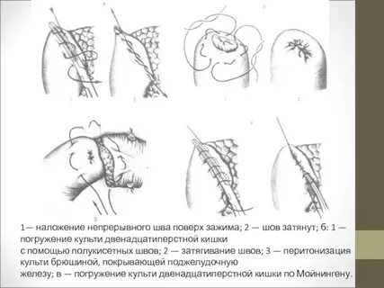 Обработка после удаления швов