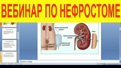Нефростом