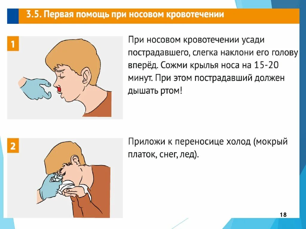 Первая помощь при носовом кровотечении алгоритм. При массовом кровотечении. Оказание ПМП при носовом кровотечении. Оказание первой помощи при кровохарканье. Необходимые действия при носовом кровотечении