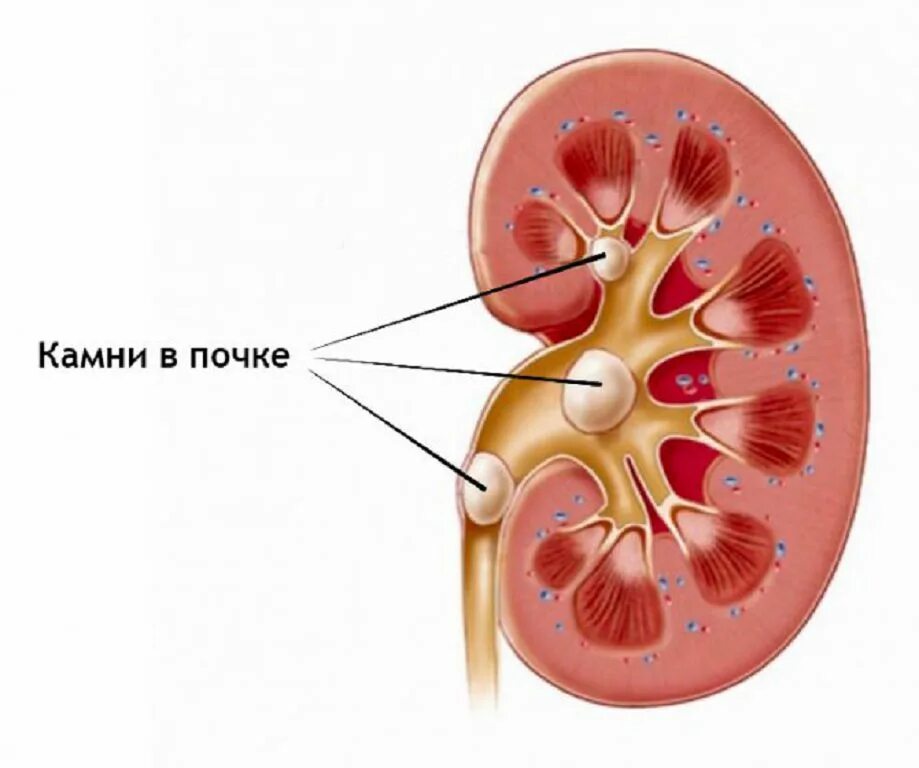 Почка округлой формы