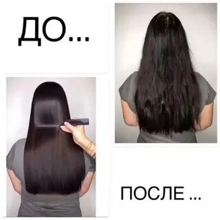 Можно ли ботокс при беременности