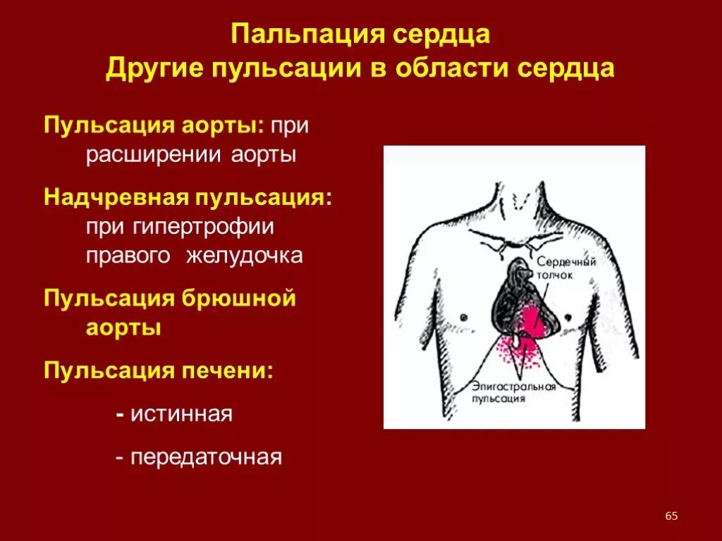 Почему сильно пульсирует в животе. Аортальная эпигастральная пульсация. Пальпация области сердца. Брюшная аорта пульсирует. Эпигатсральная пальпация сердце.