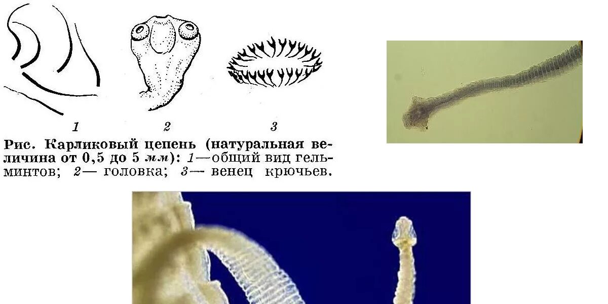 Ленточные черви паразиты карликовый цепень. Hymenolepis Nana – карликовый цепень-гименолепидоз. Hymenolepis Nana строение. Половозрелая особь карликового цепня. Карликовый цепень строение