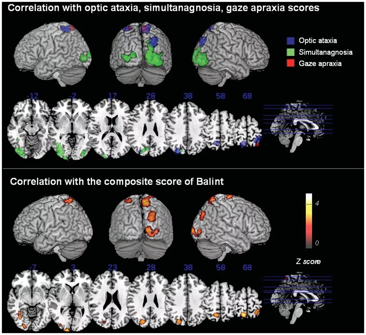 Brain 8 1. Apraxia группа. Атаксия и апраксия. Apraxia gif. Neuropsychological diagnosis of Apraxia in local Brain lesionsand its research methods.
