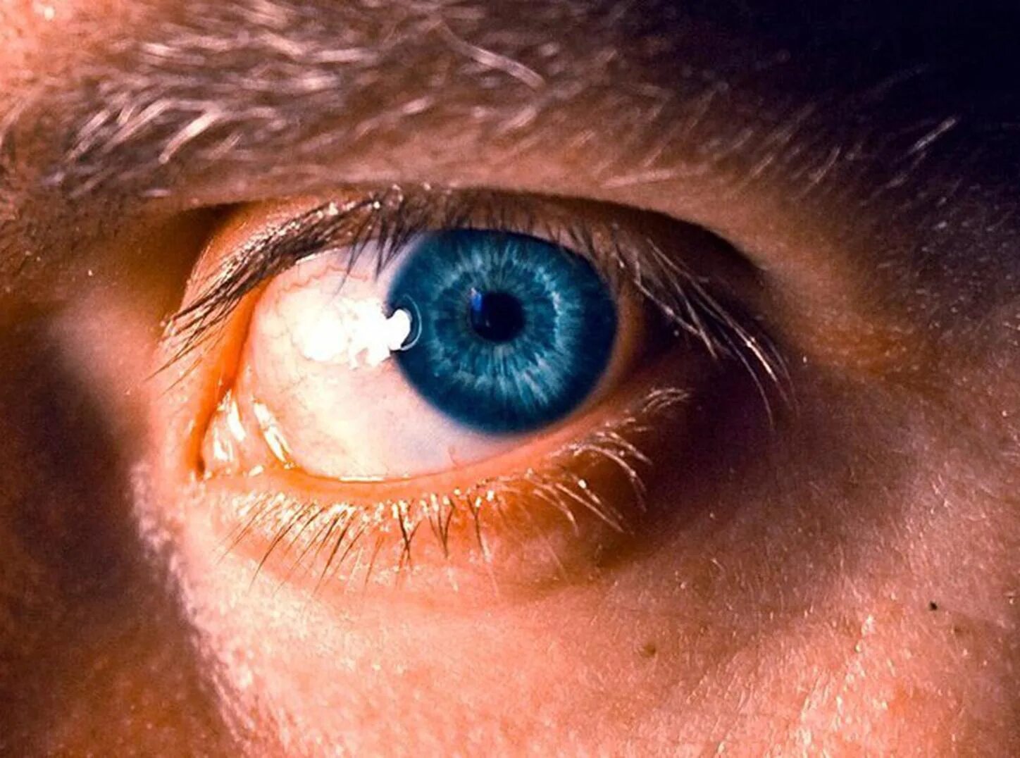 Глаза громадные как. Имплантация факичных интраокулярных линз. Глаз человека. Здоровый глаз человека.