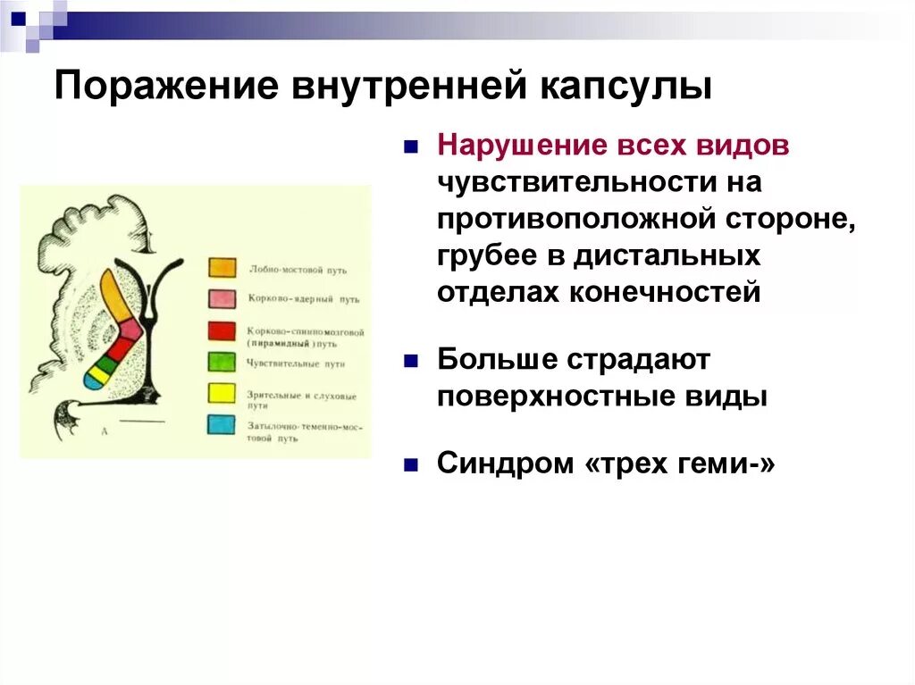 Синдромы и симптомы поражения внутренней капсулы. Внутренняя капсула неврология строение. Нарушение чувствительности при поражении внутренней капсулы. Синдромы поражения правой внутренней капсулы.