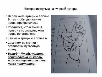 Пульс исследуют на артерии